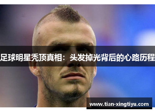 足球明星秃顶真相：头发掉光背后的心路历程