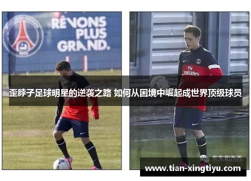 歪脖子足球明星的逆袭之路 如何从困境中崛起成世界顶级球员